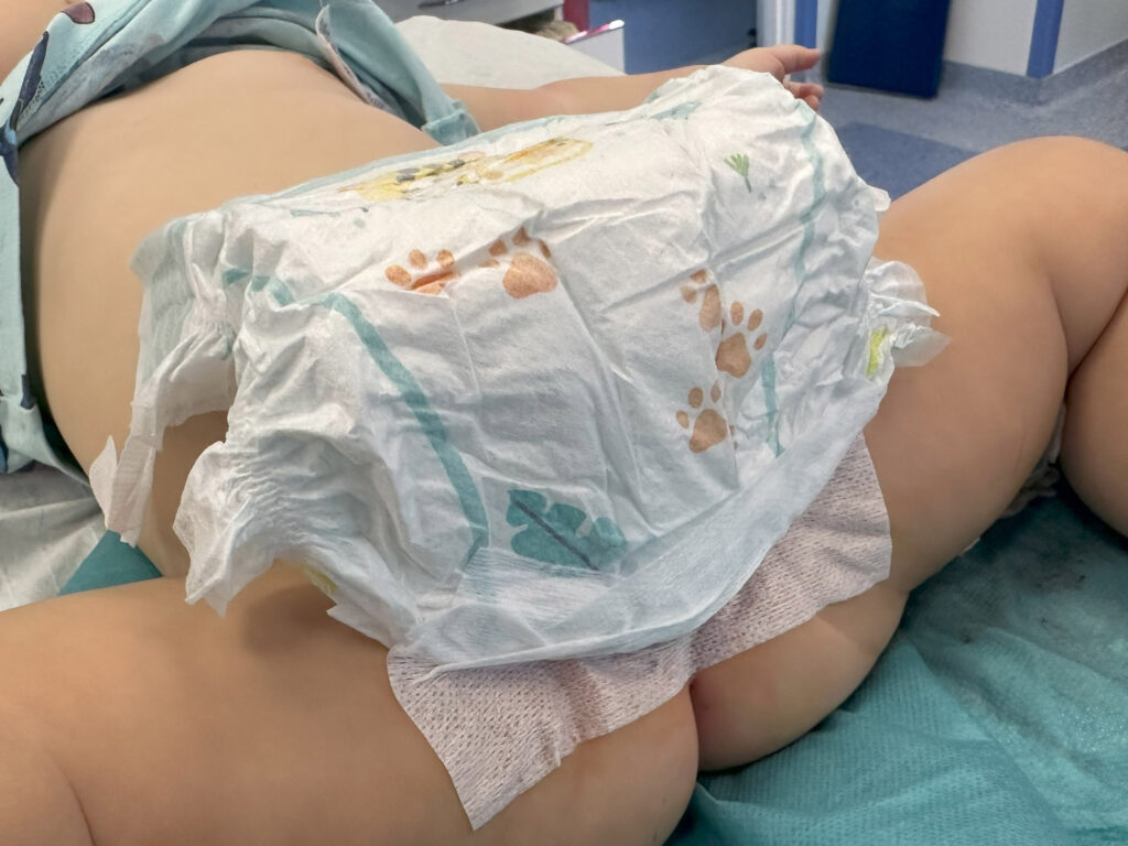 Opatrunek i pampersowanie chorego po zabiegu spodziectwa