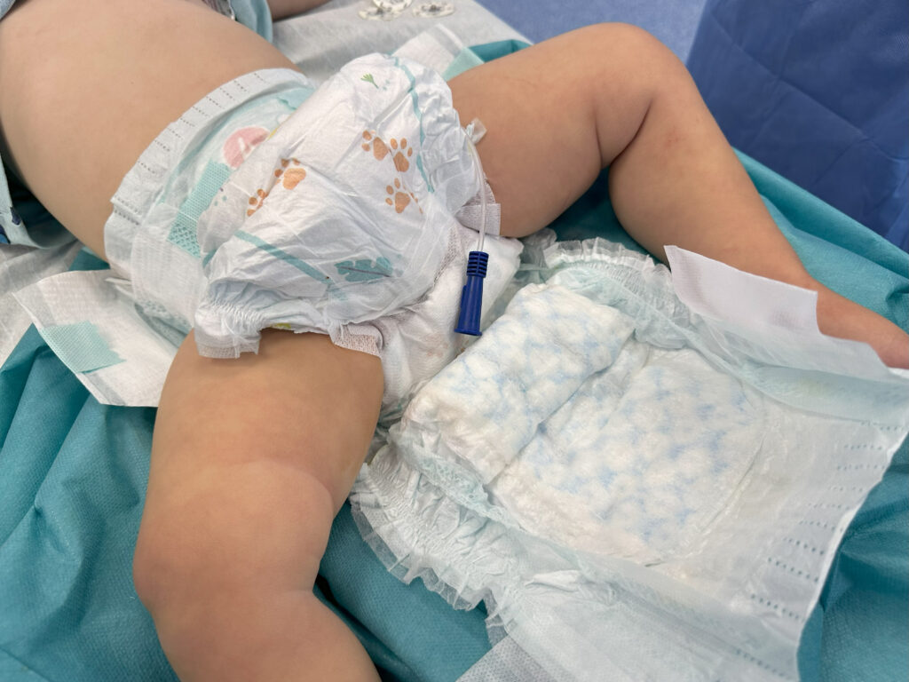 Opatrunek i pampersowanie chorego po zabiegu spodziectwa
