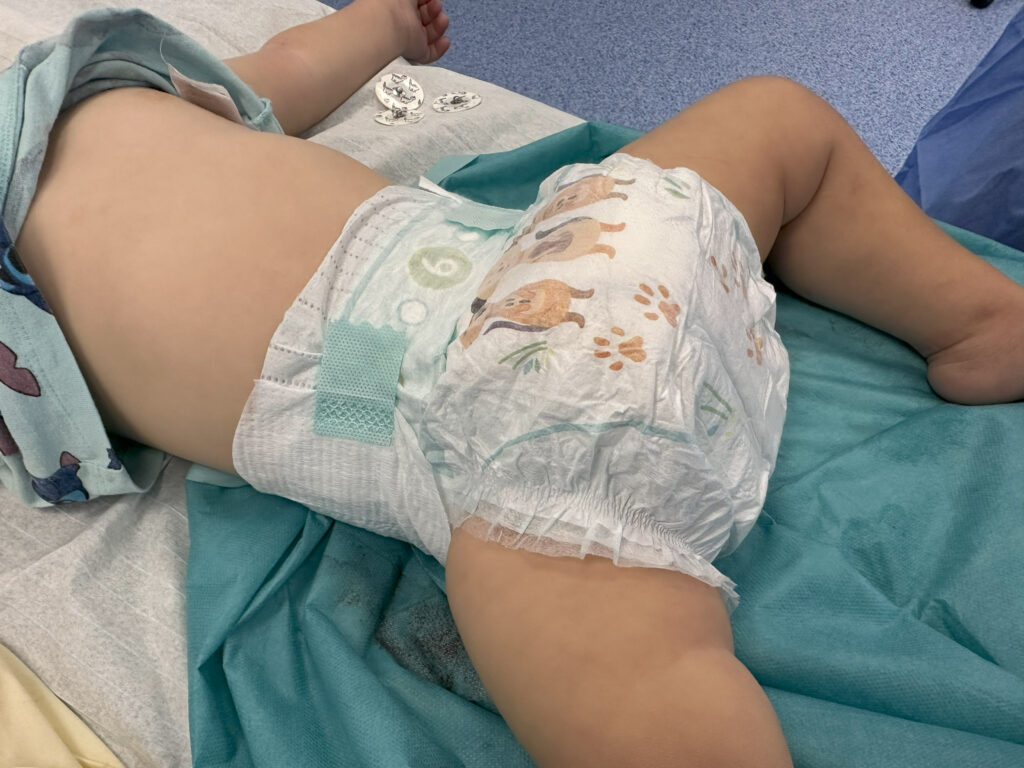 Opatrunek i pampersowanie chorego po zabiegu spodziectwa