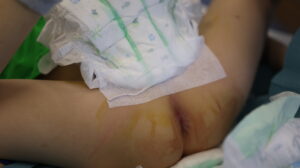 przedni pampers